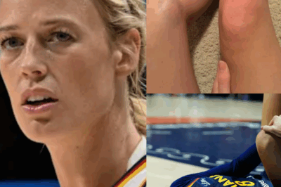 Sophie Cunningham  Set to Undergoes Surgery today Asks Fans for Support.. Indiana Fever’s Sophie Cunningham Faces CHALLENGING Road Ahead: Fan-Favorite Guard Announces Surgery After Painful Injury—Fans Show INCREDIBLE Support as She Begins Her Recovery Journey; What Really Happened and How Will This Affect Her Season?